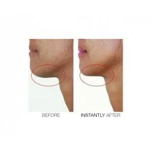 Chin Tuck V Shape Lifting Serum Mini