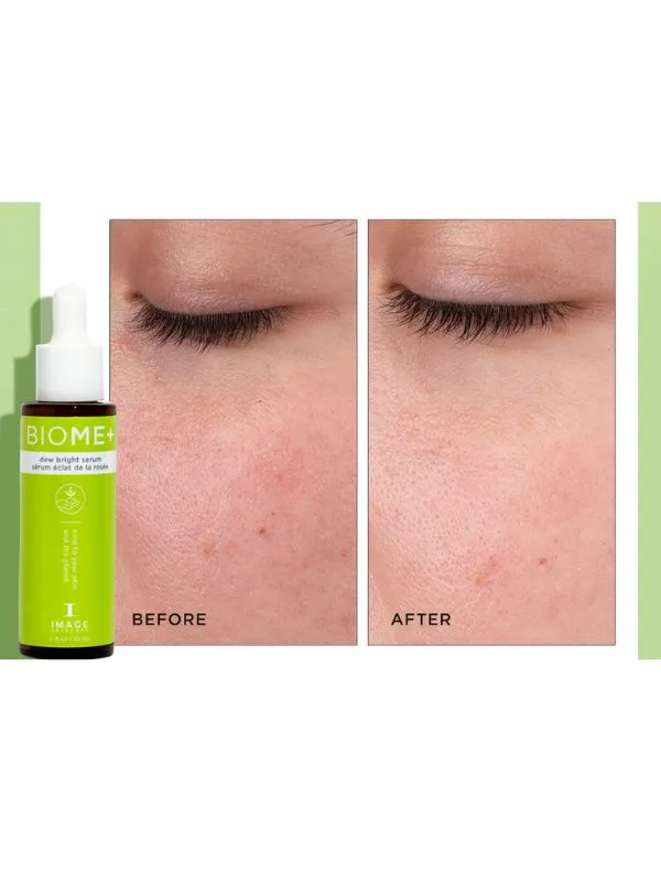 Image Skincare BIOME  Dew Bright Serum